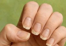 Splittern oder brechen Ihre Nägel ständig? Das ist es, was Ihr Körper Ihnen sagen möchte.