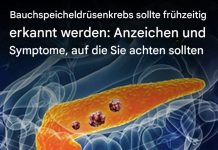 10 Anzeichen von Bauchspeicheldrüsenkrebs, die Sie nicht ignorieren sollten