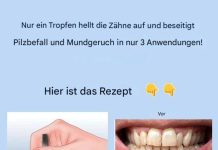 Entfernen Sie Zahnstein und bleichen Sie Ihre Zähne mit diesem einfachen Rezept.