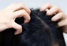 Juckt Ihre Kopfhaut? Hier sind die Hauptursachen.