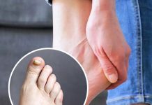 Ein Apotheker enthüllt zwei Warnzeichen für einen stillen Mörder, die Sie an Ihren Füßen erkennen könnten