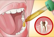 Natürliche Heilmittel gegen Zahnschmerzen, die Ihr Zahnarzt Ihnen nicht verraten möchte
