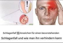 10 Frühwarnzeichen für einen Schlaganfall: So signalisiert Ihr Körper einen drohenden Notfall