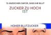 12 Anzeichen dafür, dass Ihr Zuckerhaushalt im Körper aus dem Gleichgewicht ist