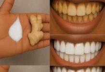 Zähne auf natürliche Weise in nur wenigen Minuten mit Ingwer und Salz aufhellen: Ein wirksames Hausmittel