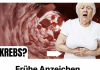 „Frühe Anzeichen von Darmkrebs, die Frauen oft ignorieren! DAS müssen Sie wissen!“