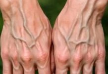 Warum haben manche Menschen sehr ausgeprägte Venen in ihren Händen? Finden Sie es hier heraus.