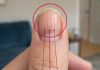 Linien auf Ihren Fingernägeln: Was sie über Ihre Gesundheit verraten könnten