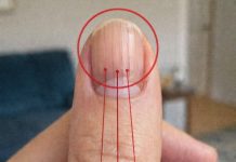 Linien auf Ihren Fingernägeln: Was sie über Ihre Gesundheit verraten könnten