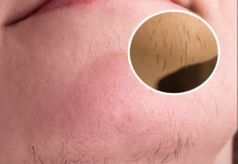 Wenn du eine Frau mit Kinnhaaren bist, bedeutet das Folgendes