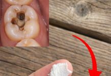 5 einfache natürliche Hausmittel, die helfen können, Karies vorzubeugen und gesunde Zähne zu unterstützen