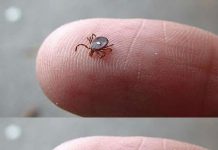 Das solltest du tun, wenn du eine Lone-Star-Zecke entdeckst
