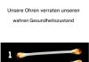 Unsere Ohren verraten den wahren Zustand unserer Gesundheit