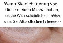 Accueil – Der wichtigste Mangel hinter Altersflecken