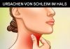 Die wahren Ursachen für Schleim und ständigen Schleim im Hals und wie man ihn loswird