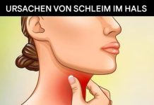 Die wahren Ursachen für Schleim und ständigen Schleim im Hals und wie man ihn loswird