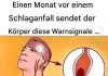 Schlaganfall symptome: Was sind die Warnsignale?