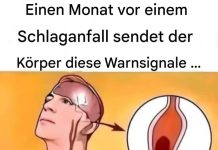 Schlaganfall symptome: Was sind die Warnsignale?