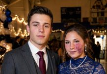 Die attraktivste Junge der Schule lud mich trotz meines Muttermals im Gesicht zum Abschlussball ein – und alle lachten, bis plötzlich die Schulleitung den Saal betrat.
