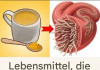 7 Lebensmittel, die Würmer im Darm abtöten