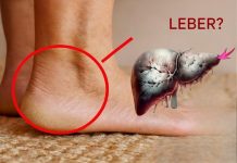 Deine Füße schreien nach Aufmerksamkeit: 6 schockierende Gesundheitshinweise, die in deinen Sohlen versteckt sind