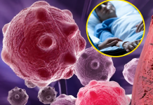 8 Lebensmittel, die Entzündungen reduzieren und das Immunsystem stärken – der perfekte Start in den Tag